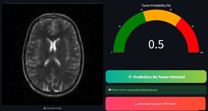 NeuroScan AI – screenshot 5