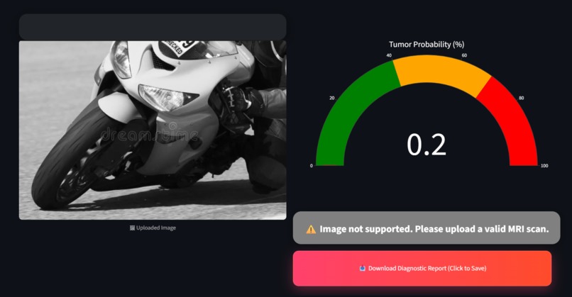 NeuroScan AI – screenshot 6