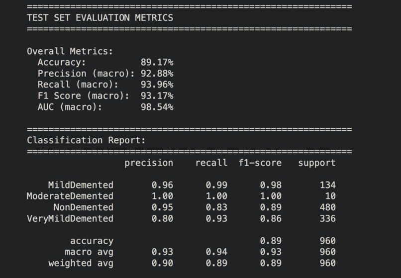 Early Alzheimer's Detection AI – screenshot 6