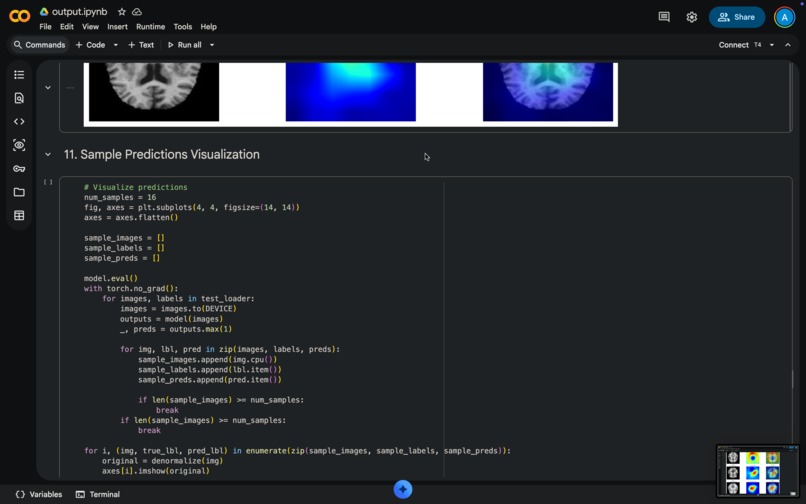 Early Alzheimer's Detection AI – screenshot 9