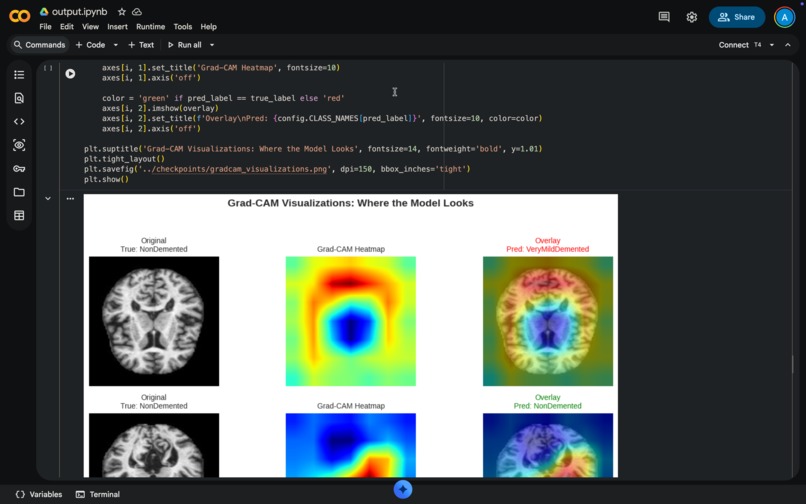 Early Alzheimer's Detection AI – screenshot 10