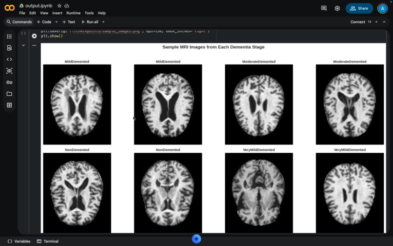 Early Alzheimer's Detection AI – screenshot 11