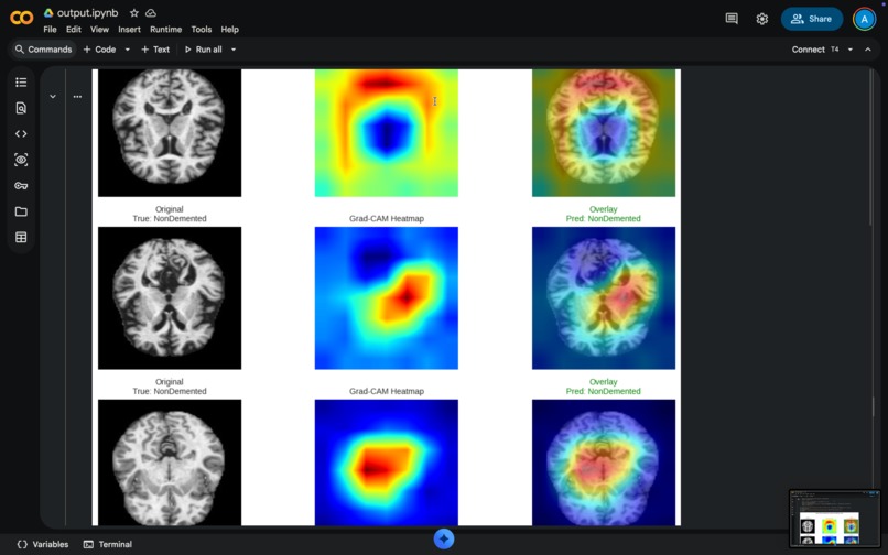 Early Alzheimer's Detection AI – screenshot 12
