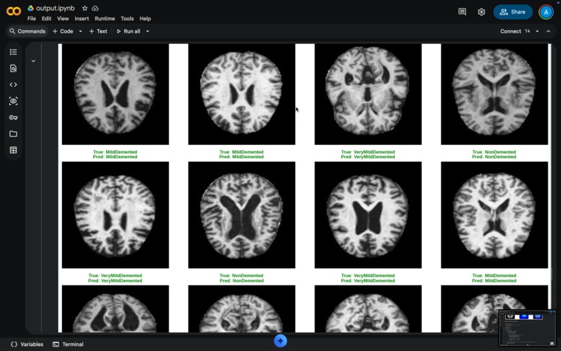 Early Alzheimer's Detection AI – screenshot 13