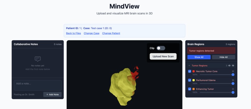 MindView – screenshot 1