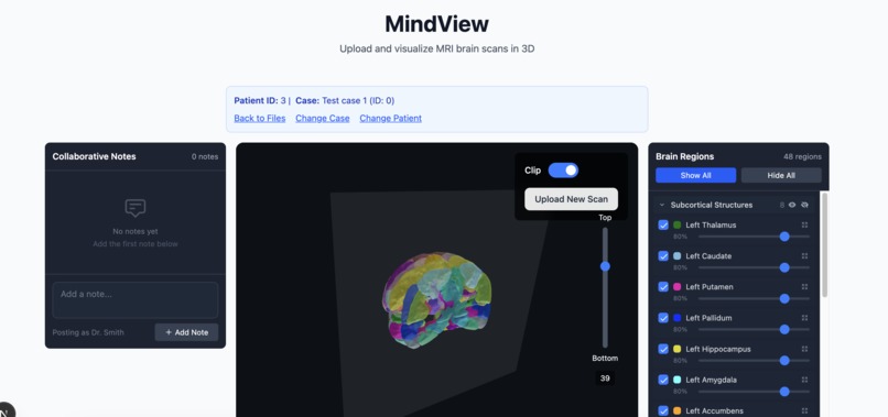 MindView – screenshot 2
