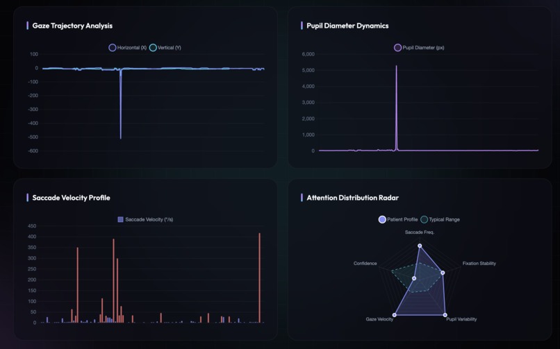 EXCITE.AI – screenshot 1