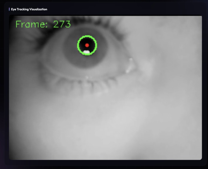 EXCITE.AI – screenshot 6