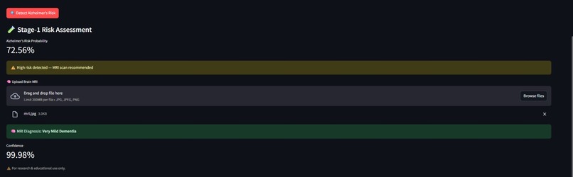 Alzheimer’s Multi-Stage AI Diagnosis System – screenshot 3