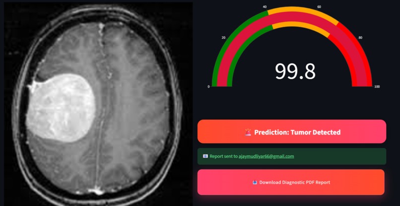 NeuroScan AI – screenshot 4