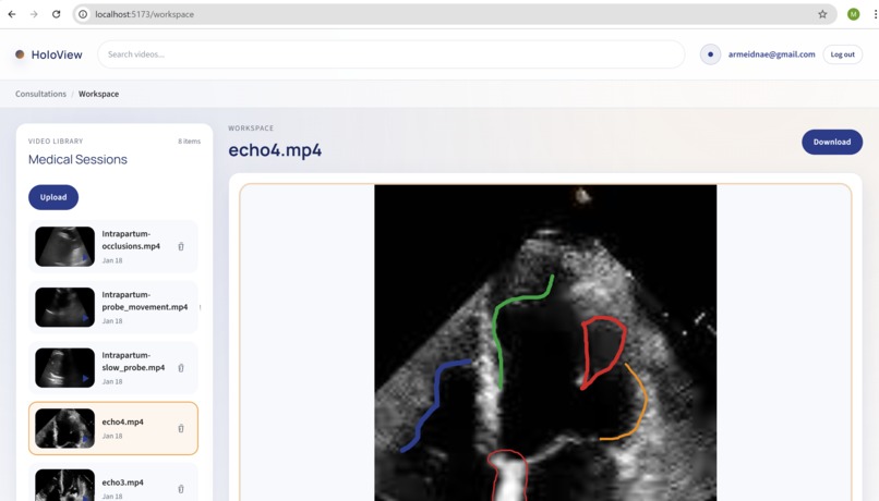 HoloView – screenshot 3