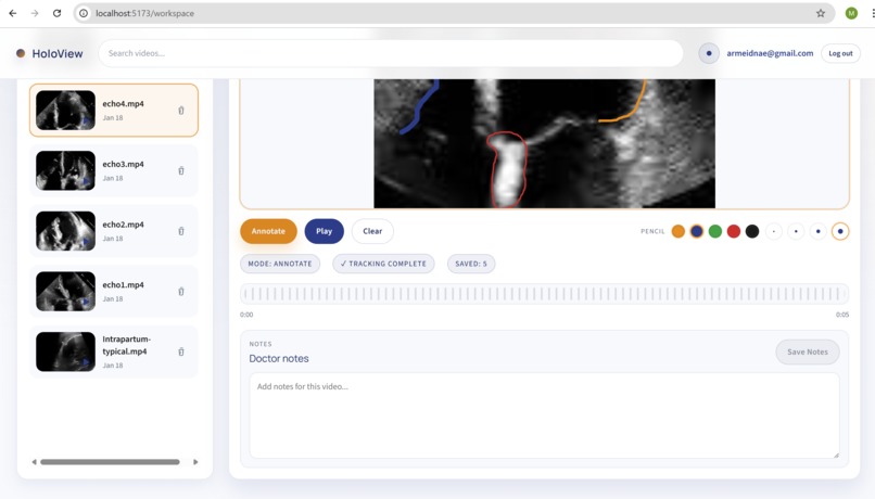 HoloView – screenshot 4