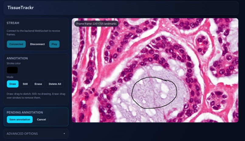 TissueTrackr – screenshot 1