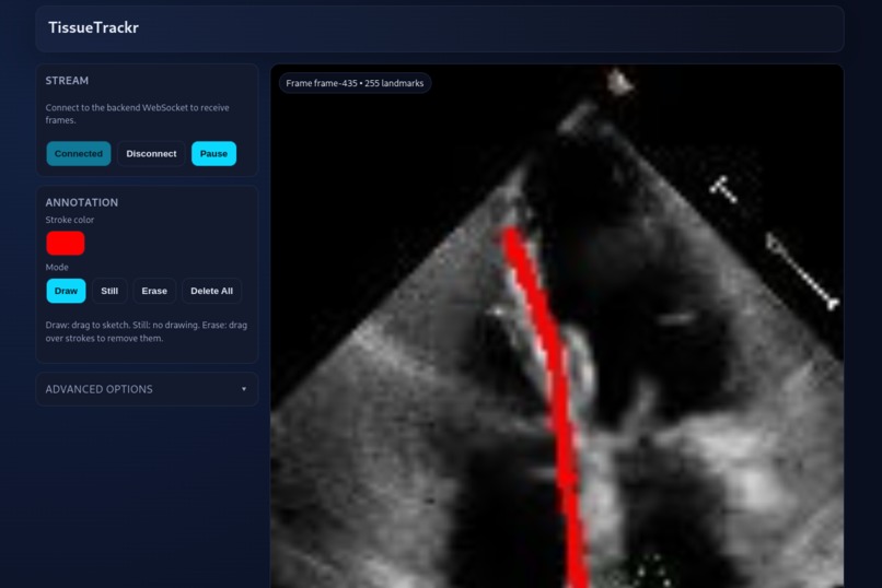 TissueTrackr – screenshot 2