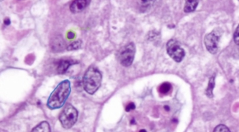 MedVision – screenshot 2