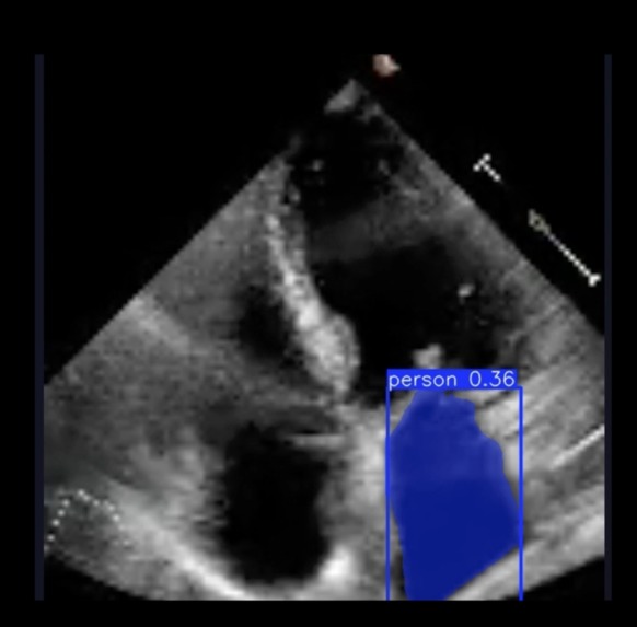 MedVision – screenshot 3