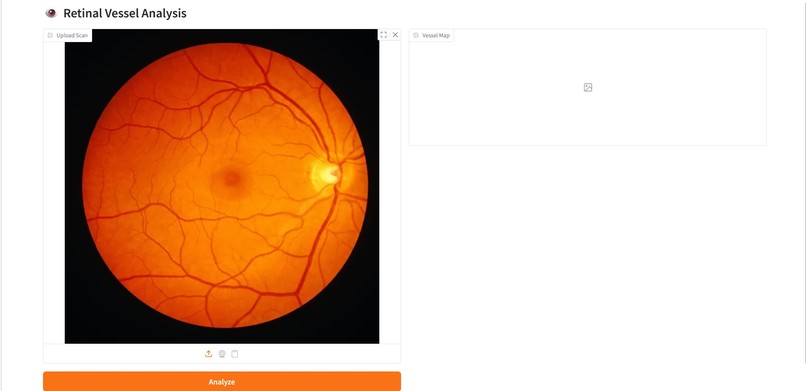 Retina-Vessel-AI-Analyzer – screenshot 2