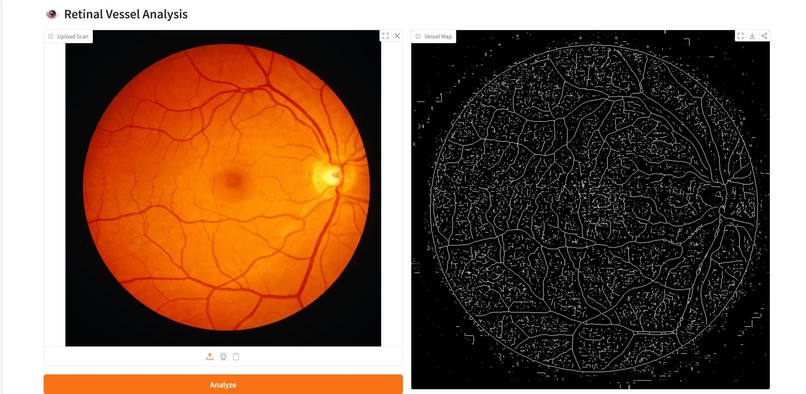 Retina-Vessel-AI-Analyzer – screenshot 3