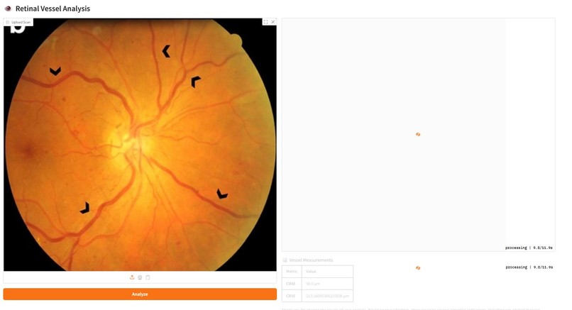 Retina-Vessel-AI-Analyzer – screenshot 4