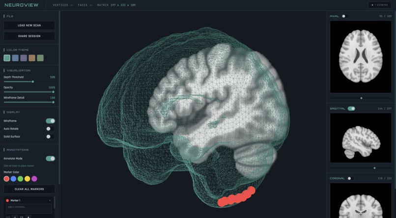 Neuroview – screenshot 1