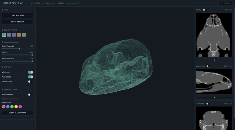 Neuroview – screenshot 2