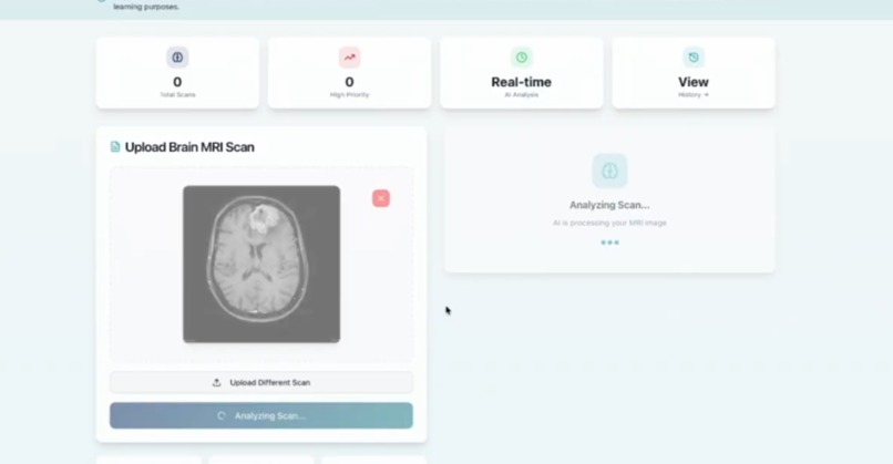 NeuroScan AI – screenshot 5