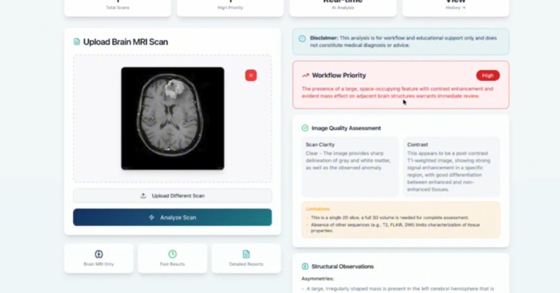 NeuroScan AI – screenshot 6