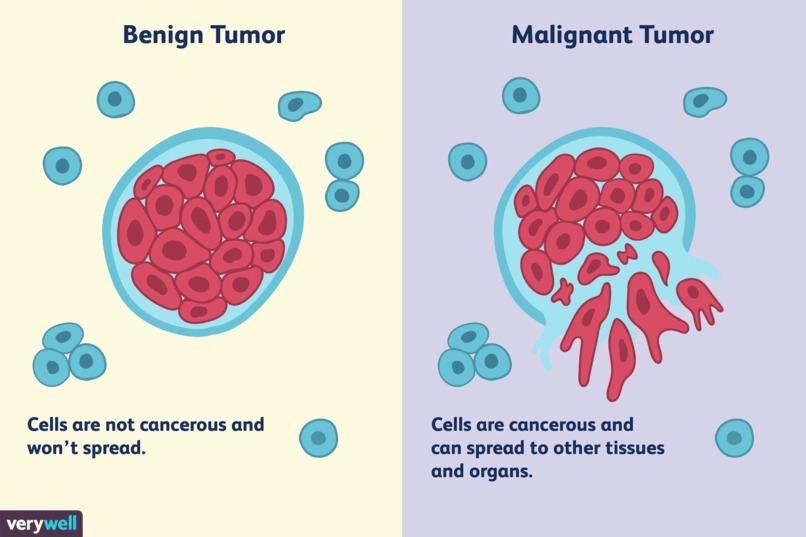 Breast Cancer Classifier – screenshot 1