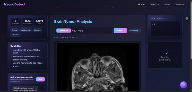 NeuroDetect – screenshot 3
