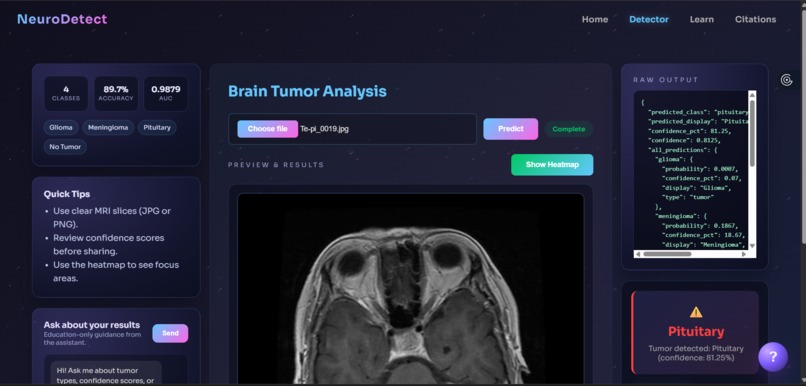 NeuroDetect – screenshot 4