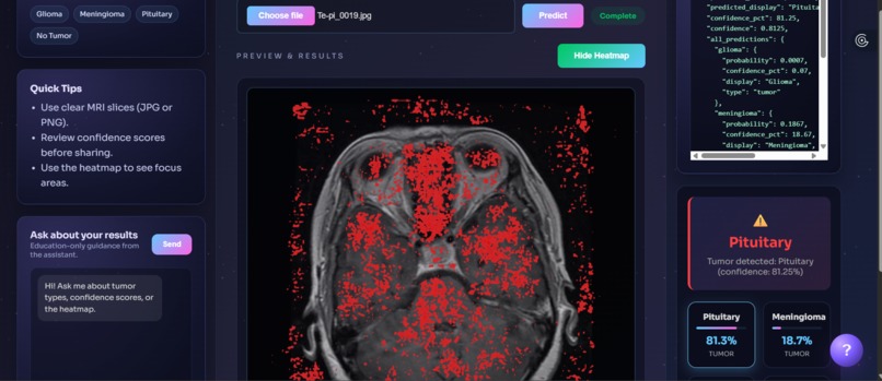 NeuroDetect – screenshot 5