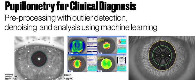 Detection genetic diseases using accelerometry – screenshot 1