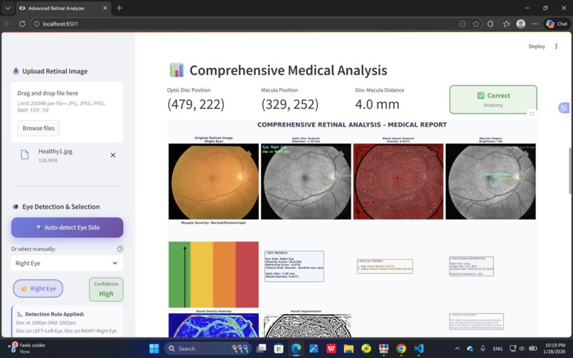 Intelligent Fundus-Based Myopia Detection – screenshot 4