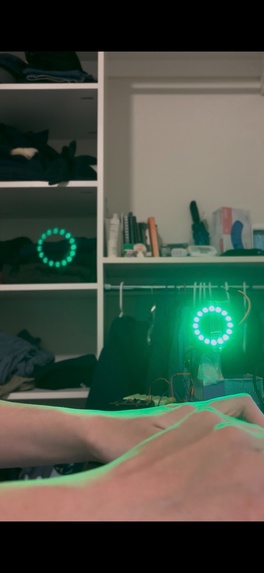 Autonomous Surgical Light – screenshot 2