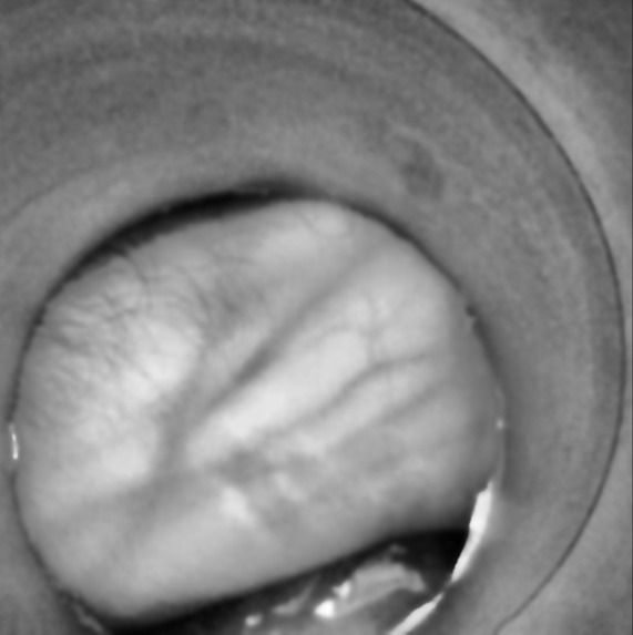 IR vein finder – screenshot 1