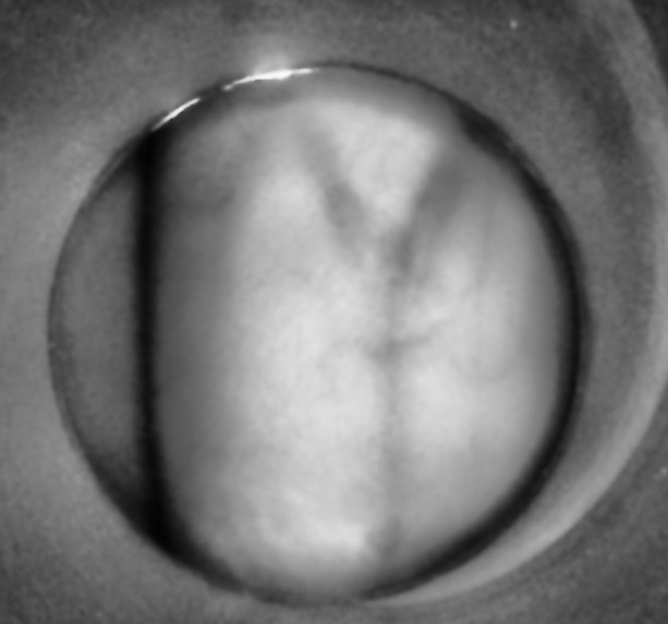 IR vein finder – screenshot 2