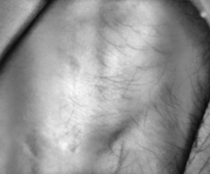 IR vein finder – screenshot 3