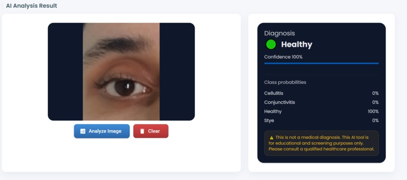 AI Eye Detection — Dual Model Classifier – screenshot 2