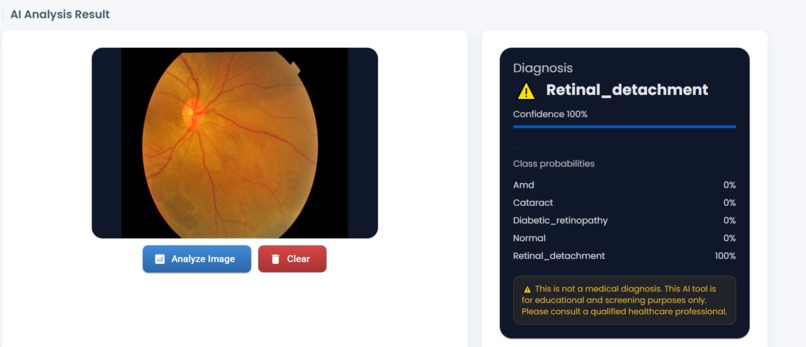 AI Eye Detection — Dual Model Classifier – screenshot 3