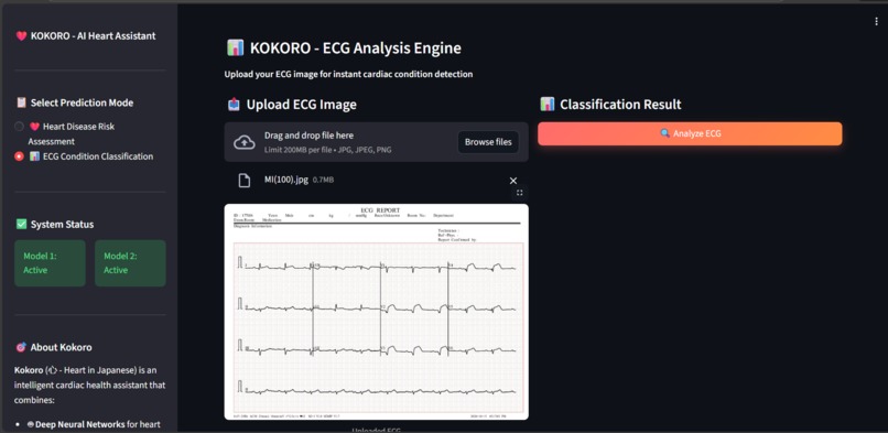Kokoro - Intelligent Cardiac Health Analysis – screenshot 8