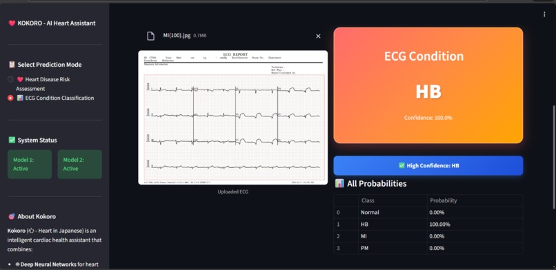 Kokoro - Intelligent Cardiac Health Analysis – screenshot 9