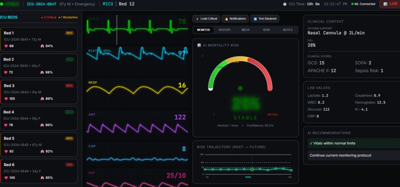 smart  machine  learning icu project – screenshot 1