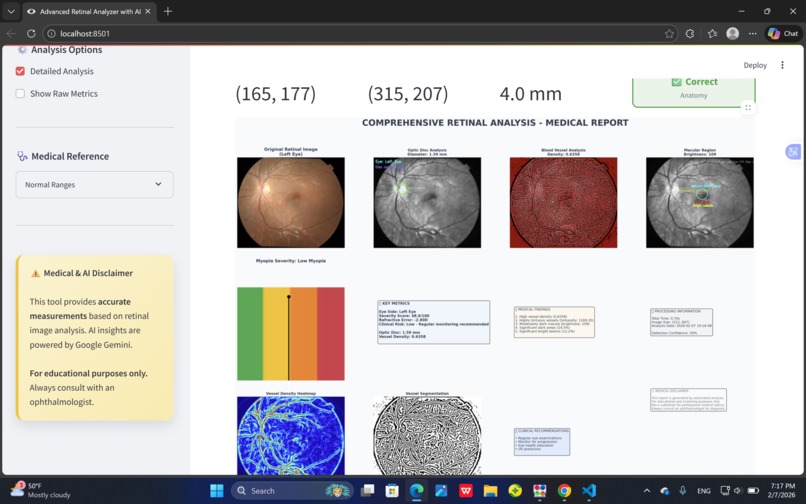 Gemini AI for Early Myopia Screening – screenshot 6