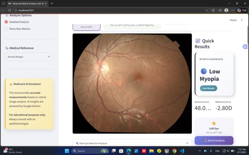 Gemini AI for Early Myopia Screening – screenshot 7