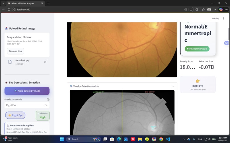 Smart Retina Analyzer – screenshot 4