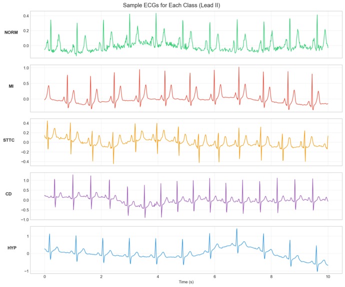 TrustECG – screenshot 4