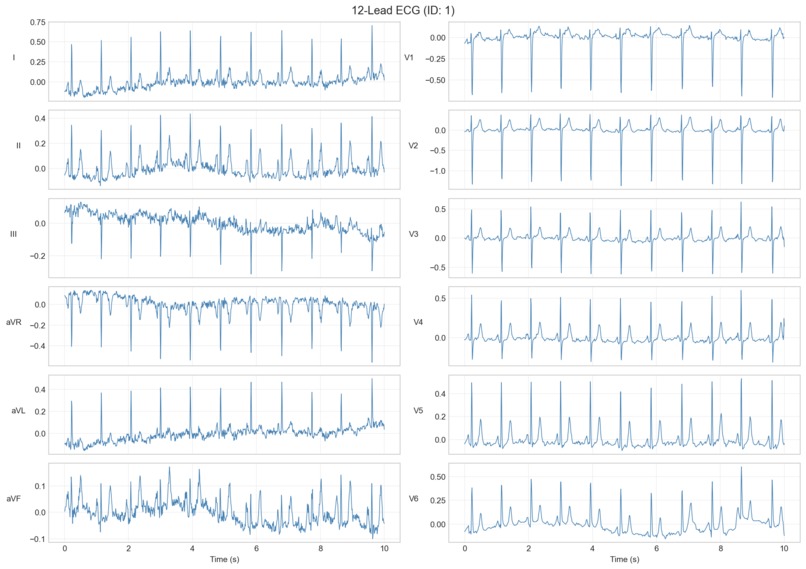 TrustECG – screenshot 5