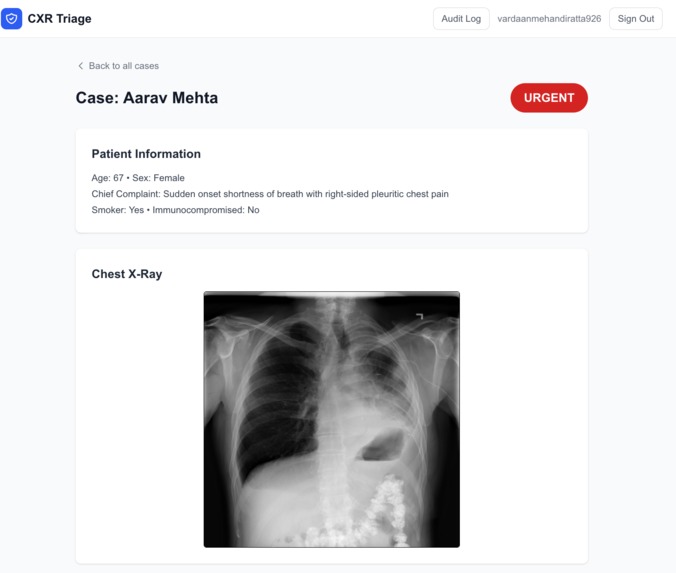 CXR – screenshot 3