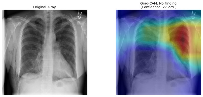 CXR – screenshot 1