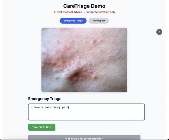 CareTriage AI – screenshot 2